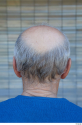 Head Hair Man White Casual Average Bald Street photo references